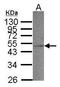 Short-chain specific acyl-CoA dehydrogenase, mitochondrial antibody, GTX100490, GeneTex, Western Blot image 