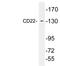 CD22 Molecule antibody, LS-C199793, Lifespan Biosciences, Western Blot image 