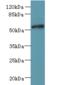 Family With Sequence Similarity 126 Member B antibody, A59018-100, Epigentek, Western Blot image 