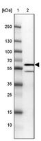 Sorting Nexin 8 antibody, PA5-63428, Invitrogen Antibodies, Western Blot image 