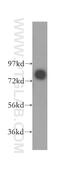 ABCD1 antibody, 11159-1-AP, Proteintech Group, Western Blot image 
