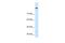 Cordon-Bleu WH2 Repeat Protein Like 1 antibody, A09817, Boster Biological Technology, Western Blot image 