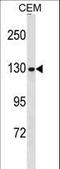 Non-SMC Condensin I Complex Subunit G antibody, LS-C158364, Lifespan Biosciences, Western Blot image 