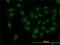 Cyclin Dependent Kinase 6 antibody, H00001021-M01, Novus Biologicals, Immunocytochemistry image 