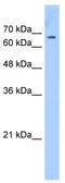 Chromodomain Y-Linked 1B antibody, TA346731, Origene, Western Blot image 