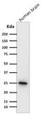 Ubiquitin C-Terminal Hydrolase L1 antibody, GTX34969, GeneTex, Western Blot image 