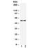 Solute Carrier Family 2 Member 1 antibody, R31941, NSJ Bioreagents, Western Blot image 