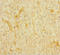 Proopiomelanocortin antibody, A53537-100, Epigentek, Immunohistochemistry paraffin image 