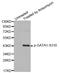 GATA Binding Protein 1 antibody, LS-C335994, Lifespan Biosciences, Western Blot image 