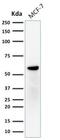 Estrogen Receptor 2 antibody, NBP2-29439, Novus Biologicals, Western Blot image 