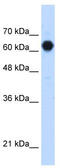 Protein O-Linked Mannose N-Acetylglucosaminyltransferase 2 (Beta 1,4-) antibody, TA346854, Origene, Western Blot image 