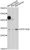 Protein Phosphatase 1 Regulatory Subunit 3B antibody, LS-C749909, Lifespan Biosciences, Western Blot image 