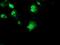 Ribosomal Protein S6 Kinase B1 antibody, NBP2-00754, Novus Biologicals, Immunocytochemistry image 