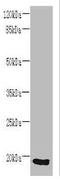 Signal Peptidase Complex Subunit 3 antibody, A63486-100, Epigentek, Western Blot image 