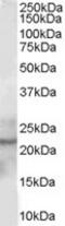 Glutathione Peroxidase 2 antibody, TA303039, Origene, Western Blot image 