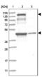 Pleckstrin Homology Domain Containing A5 antibody, NBP1-84612, Novus Biologicals, Western Blot image 
