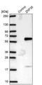 Zinc Finger Protein 35 antibody, PA5-63014, Invitrogen Antibodies, Western Blot image 