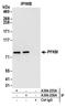 Phosphofructokinase, Muscle antibody, A304-255A, Bethyl Labs, Immunoprecipitation image 