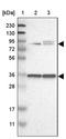 Leucine Rich Repeats And Calponin Homology Domain Containing 3 antibody, PA5-52933, Invitrogen Antibodies, Western Blot image 