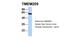 Transmembrane Protein 209 antibody, NBP1-91493, Novus Biologicals, Western Blot image 