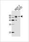 Aldehyde Dehydrogenase 6 Family Member A1 antibody, MA5-24714, Invitrogen Antibodies, Western Blot image 