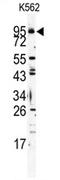 Toll-like receptor 6 antibody, AP11538PU-N, Origene, Western Blot image 