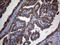 Transforming Growth Factor Beta Receptor 2 antibody, LS-C798462, Lifespan Biosciences, Immunohistochemistry paraffin image 