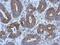 Adenylate Kinase 3 antibody, NBP2-15317, Novus Biologicals, Immunohistochemistry frozen image 