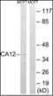 Carbonic Anhydrase 12 antibody, orb376032, Biorbyt, Western Blot image 
