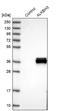 AlkB Homolog 3, Alpha-Ketoglutaratedependent Dioxygenase antibody, NBP1-84274, Novus Biologicals, Western Blot image 