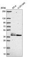 SET Domain And Mariner Transposase Fusion Gene antibody, HPA057999, Atlas Antibodies, Western Blot image 