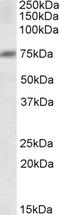 G Protein-Coupled Receptor Kinase 2 antibody, 45-711, ProSci, Western Blot image 