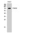 P21 (RAC1) Activated Kinase 5 antibody, STJ94939, St John