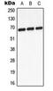 Glucokinase Regulator antibody, LS-C353986, Lifespan Biosciences, Western Blot image 