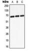 Glucokinase regulatory protein antibody, LS-C353986, Lifespan Biosciences, Western Blot image 