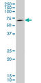 Eomesodermin antibody, LS-C198547, Lifespan Biosciences, Western Blot image 