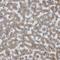 UDP-GlcNAc:BetaGal Beta-1,3-N-Acetylglucosaminyltransferase 5 antibody, HPA017292, Atlas Antibodies, Immunohistochemistry frozen image 