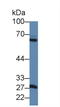 Matrix Metallopeptidase 1 antibody, LS-C720566, Lifespan Biosciences, Western Blot image 