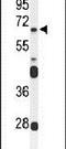 Frizzled Class Receptor 4 antibody, PA5-26481, Invitrogen Antibodies, Western Blot image 