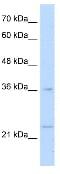 MAF BZIP Transcription Factor B antibody, ab66506, Abcam, Western Blot image 