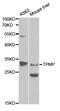 Thiopurine S-Methyltransferase antibody, LS-C331205, Lifespan Biosciences, Western Blot image 