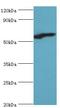 RB Binding Protein 5, Histone Lysine Methyltransferase Complex Subunit antibody, LS-C377333, Lifespan Biosciences, Western Blot image 