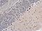 Pleiotropic Regulator 1 antibody, PA5-28418, Invitrogen Antibodies, Immunohistochemistry paraffin image 