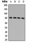 G Protein-Coupled Receptor Kinase 2 antibody, LS-C358899, Lifespan Biosciences, Western Blot image 