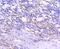 Tenascin C antibody, NBP2-67479, Novus Biologicals, Immunohistochemistry paraffin image 