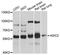 Acid Sensing Ion Channel Subunit 2 antibody, abx125538, Abbexa, Western Blot image 