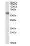 Dual Specificity Phosphatase 8 antibody, orb18363, Biorbyt, Western Blot image 