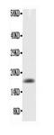 Tumor Necrosis Factor antibody, RP1000, Boster Biological Technology, Western Blot image 
