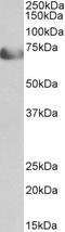 Transcription Factor 4 antibody, STJ71640, St John