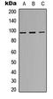 Insulin Receptor antibody, GTX55014, GeneTex, Western Blot image 